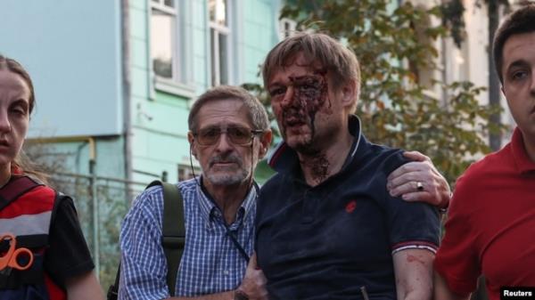 An injured man walks with paramedics after he was rescued from a residential building damaged during a Russian drone and missile strike in Lviv, Ukraine Sept. 4, 2024.