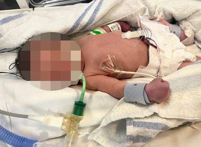 Miracle baby Posie in hospital.