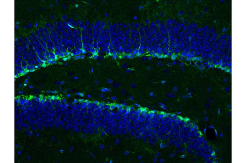 Platelets can replicate the benefits of exercise in the brain