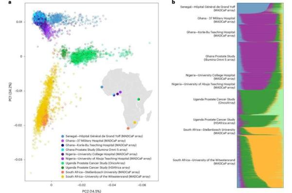 Largest study of its kind in Africa finds African men have high risk of prostate cancer, earlier
