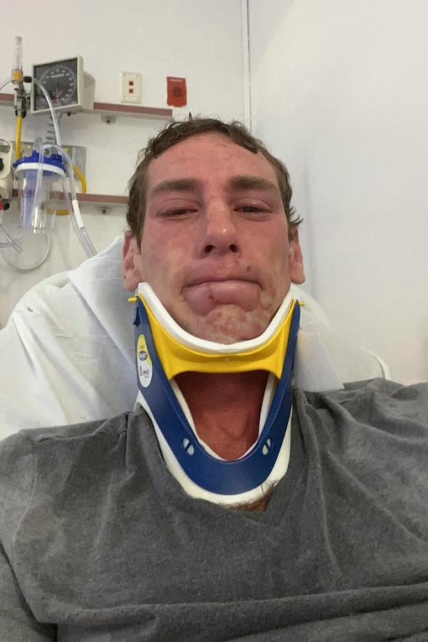 Joseph Borgen was seen wearing a neck brace after the attack.