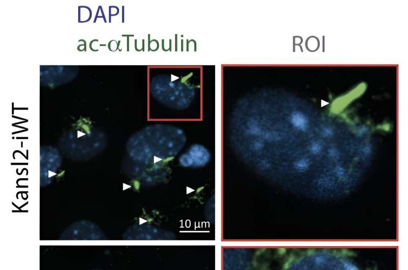 Researchers sharpen their focus on passages into the nucleus