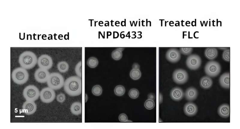 Deadly fungus beaten with new type of treatment