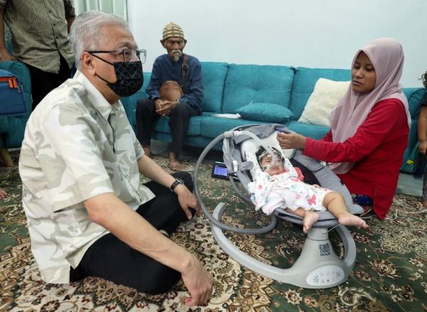 Ismail Sabri seeks Health Ministry to help baby Sufi Syafrina who needs RM9m treatment