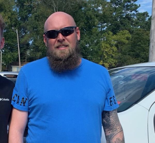 Doctors amputated his left arm above the elbow. The arm featured a significant tattoo of armor.