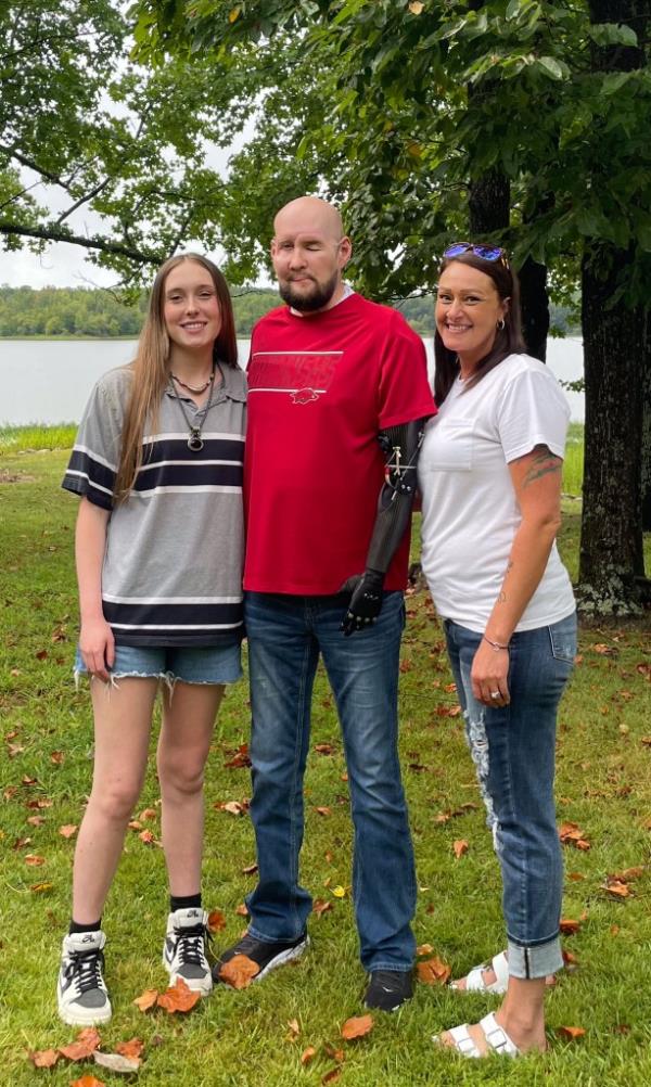 The James family is preparing to send Allie to college. This photo was taken in September 2024.