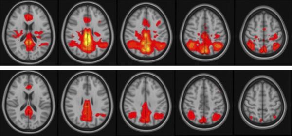 Two rows of brain images