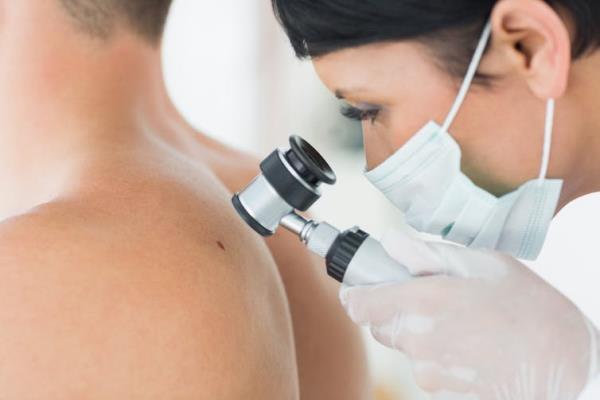 A dermatologist peers through a magnifying lens at a mole on a man's back.