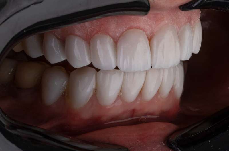 teeth germs