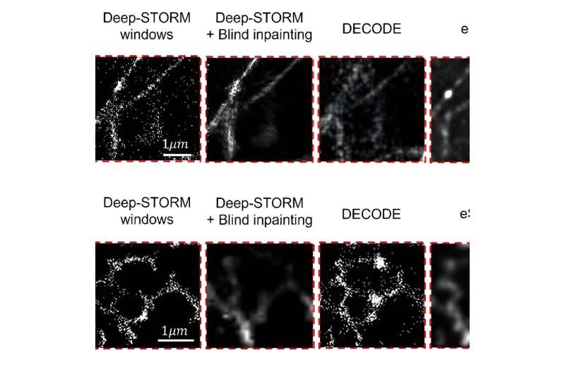 Biology in motion at super-high resolution