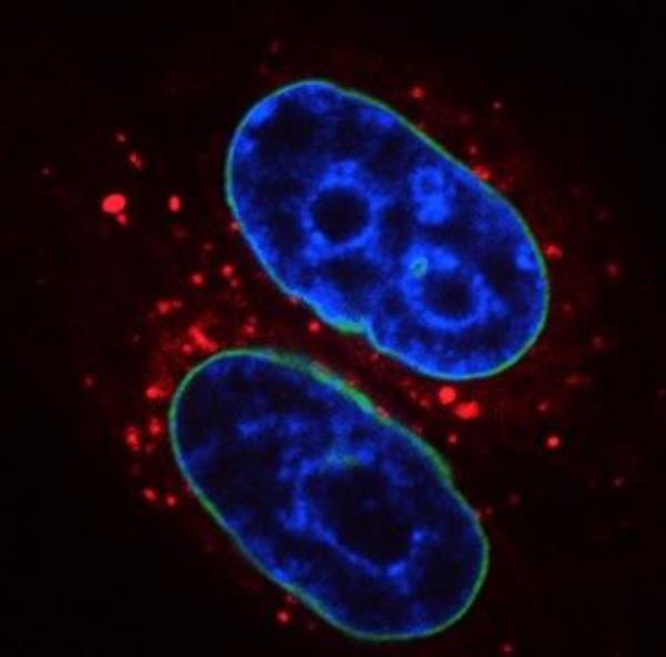 DNA Repair