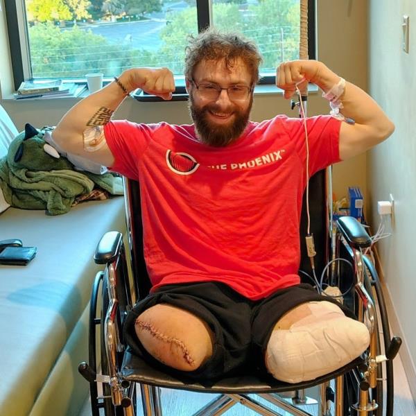 John O'Neill suffered a freak accident during his first day of work that left him with both of his legs being amputated on Sept. 24, 2024.