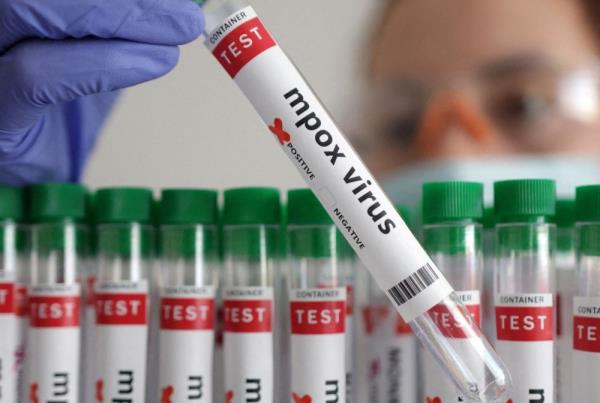 Health Ministry: No suspected mpox cases detected among 2.64 million travellers 