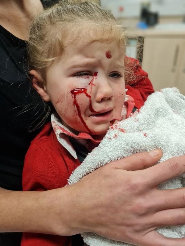 Elouise Smith needed three hours of surgery after sustaining horrific injuries