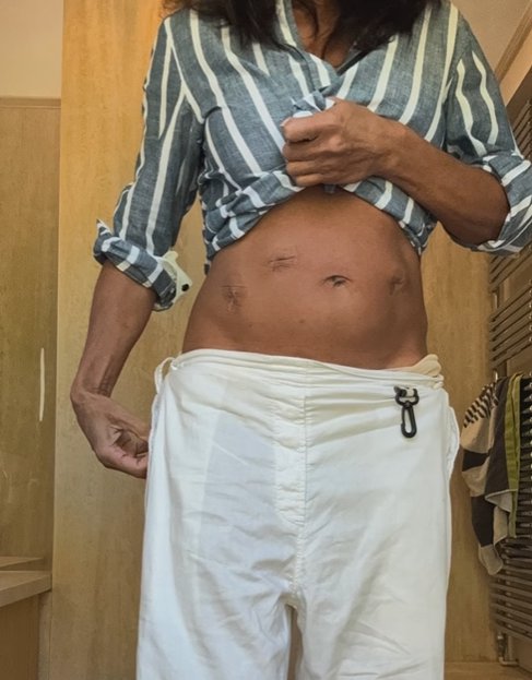 A picture of Jenny Powell's stomach.