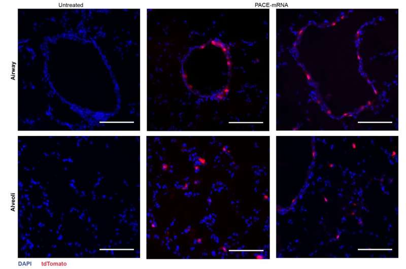 Sniffing nanoparticles loaded with mRNA could lead to advanced lung therapeutics