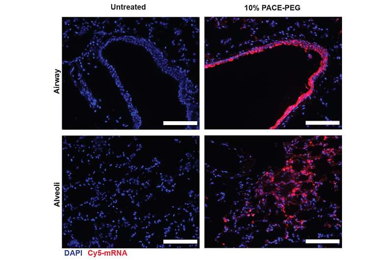 Sniffing nanoparticles loaded with mRNA could lead to advanced lung therapeutics