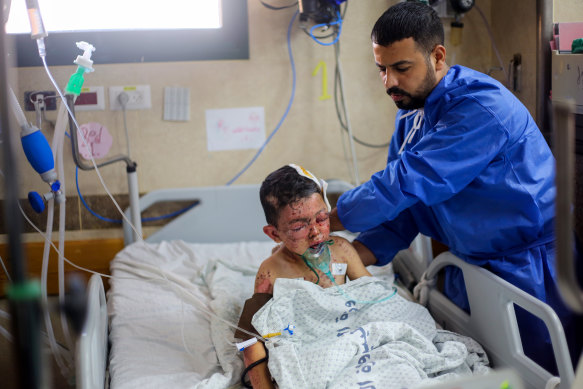An injured Palestinian child is seen in an intensive care unit at Nasser Hospital in Khan Yunis, Gaza.