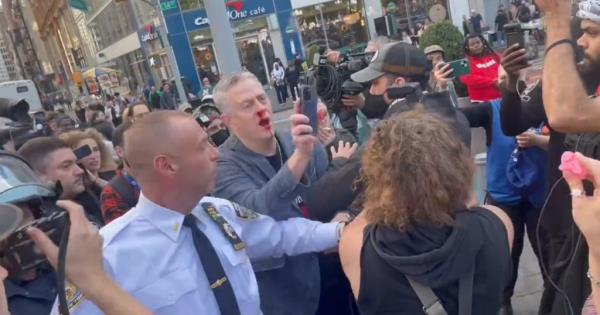 Richman, left with a bloody nose, points his phone's camera at anti-Israel protesters after he was attacked.