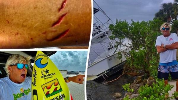 (Top L) Shark bite marks on Charley Hajek's leg show fresh blood. (Bottom L) Charley Hajek holds his surfboard and points. (R) Surfer Charley Hajek stands with his arms crossed next to a tiled boat and gloomy skies.