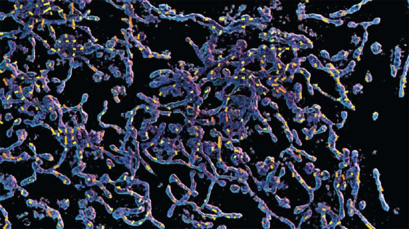 Bringing clarity to microscopic imaging