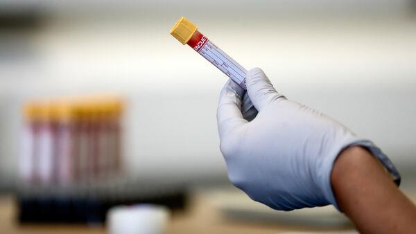 ‘Body changes up to eight years before inflammatory bowel disease diagnosis’
