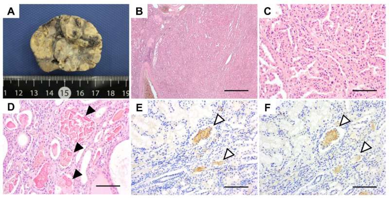 Japanese squirrels found to develop human hereditary diseases with aging