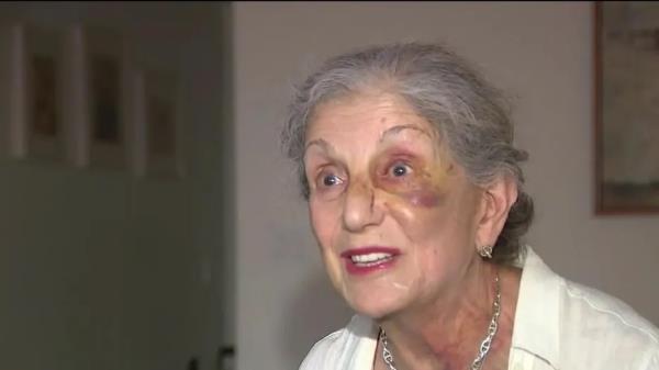 Victim Geula Freeman was knocked unconscious during the senseless attack.