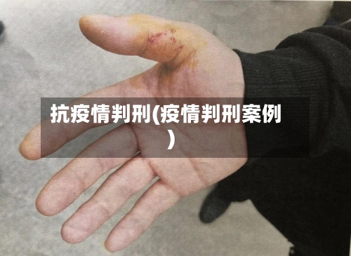 抗疫情判刑(疫情判刑案例)-第3张图片