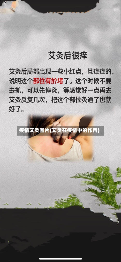 疫情艾灸图片(艾灸在疫情中的作用)