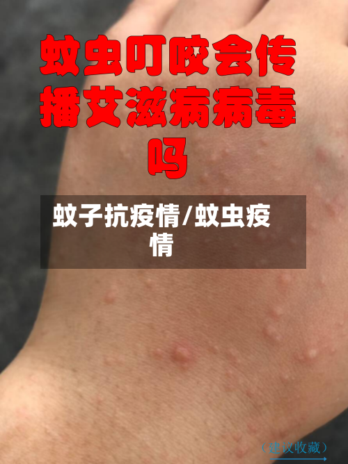 蚊子抗疫情/蚊虫疫情